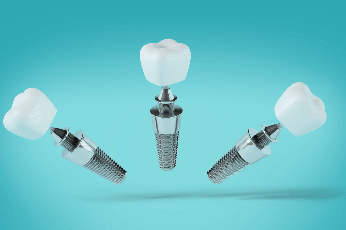 dental implants